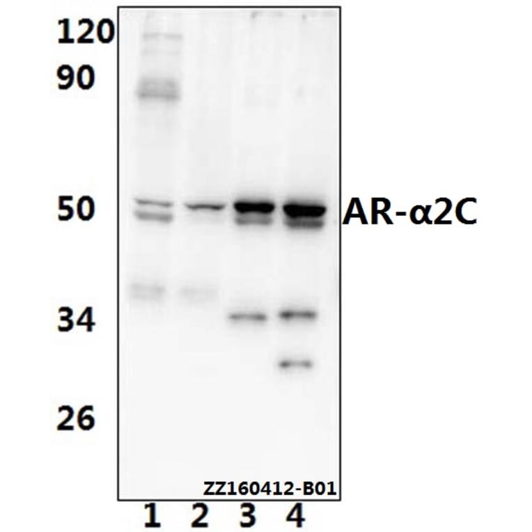 Anti-AR-α2C (R369) Antibody from Bioworld Technology (BS1945) - Antibodies.com