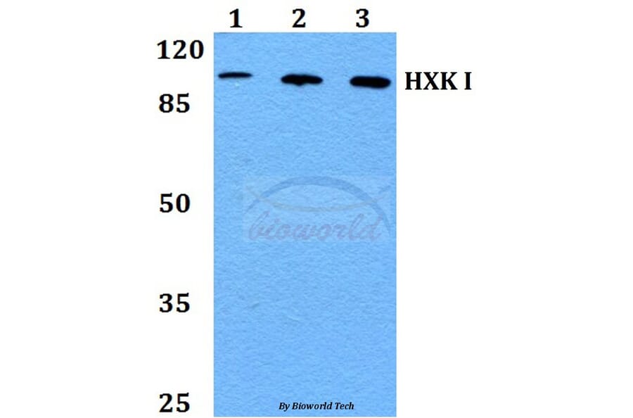 Anti-HXK I (F67) Antibody from Bioworld Technology (BS1947) - Antibodies.com