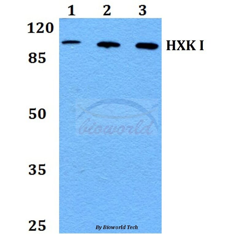 Anti-HXK I (F67) Antibody from Bioworld Technology (BS1947) - Antibodies.com