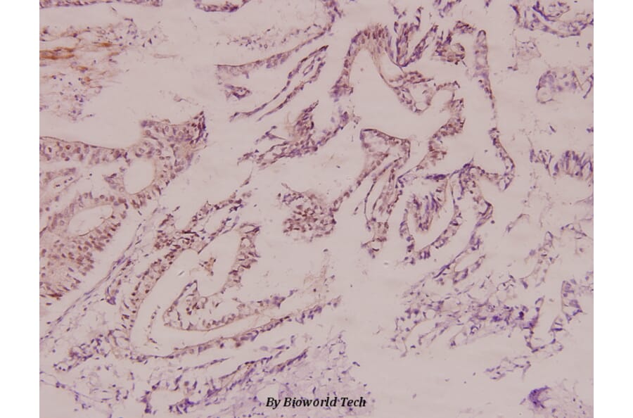 Anti-HXK I (F67) Antibody from Bioworld Technology (BS1947) - Antibodies.com