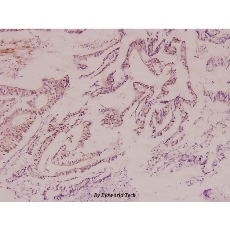 Anti-HXK I (F67) Antibody from Bioworld Technology (BS1947) - Antibodies.com
