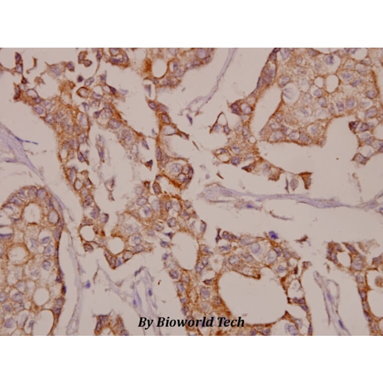 Anti-Elk-1 (E33) Antibody from Bioworld Technology (BS1948) - Antibodies.com