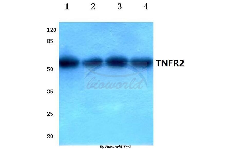 Anti-TNF-R2 (P412) Antibody from Bioworld Technology (BS1949) - Antibodies.com