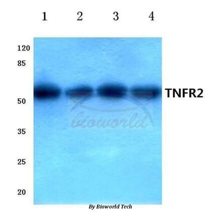 Anti-TNF-R2 (P412) Antibody from Bioworld Technology (BS1949) - Antibodies.com