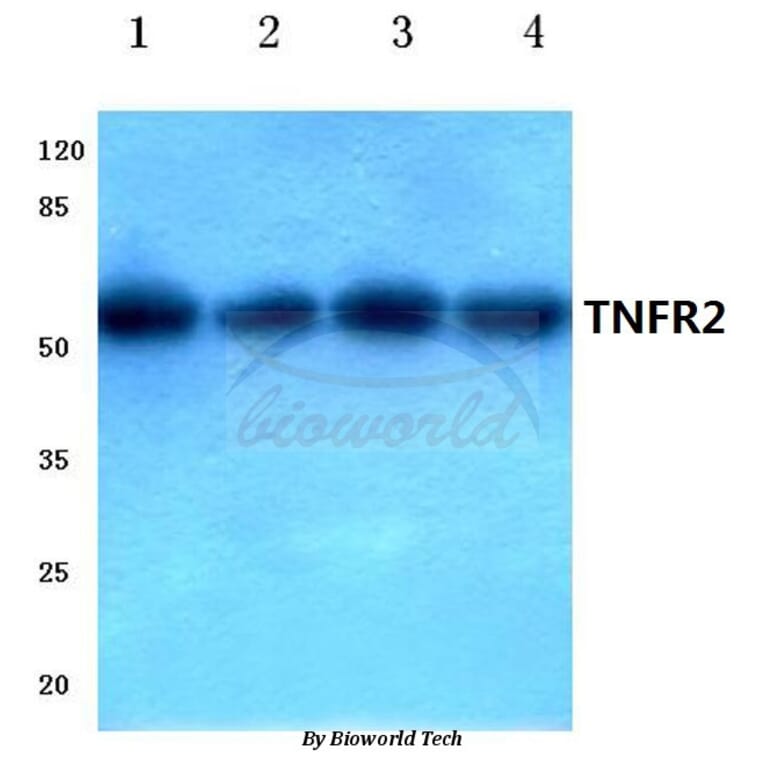 Anti-TNF-R2 (P412) Antibody from Bioworld Technology (BS1949) - Antibodies.com