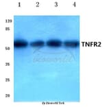 Anti-TNF-R2 (P412) Antibody from Bioworld Technology (BS1949) - Antibodies.com