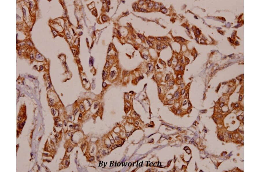 Anti-TNF-R2 (P412) Antibody from Bioworld Technology (BS1949) - Antibodies.com