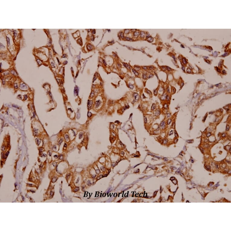 Anti-TNF-R2 (P412) Antibody from Bioworld Technology (BS1949) - Antibodies.com