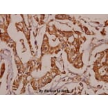 Anti-TNF-R2 (P412) Antibody from Bioworld Technology (BS1949) - Antibodies.com