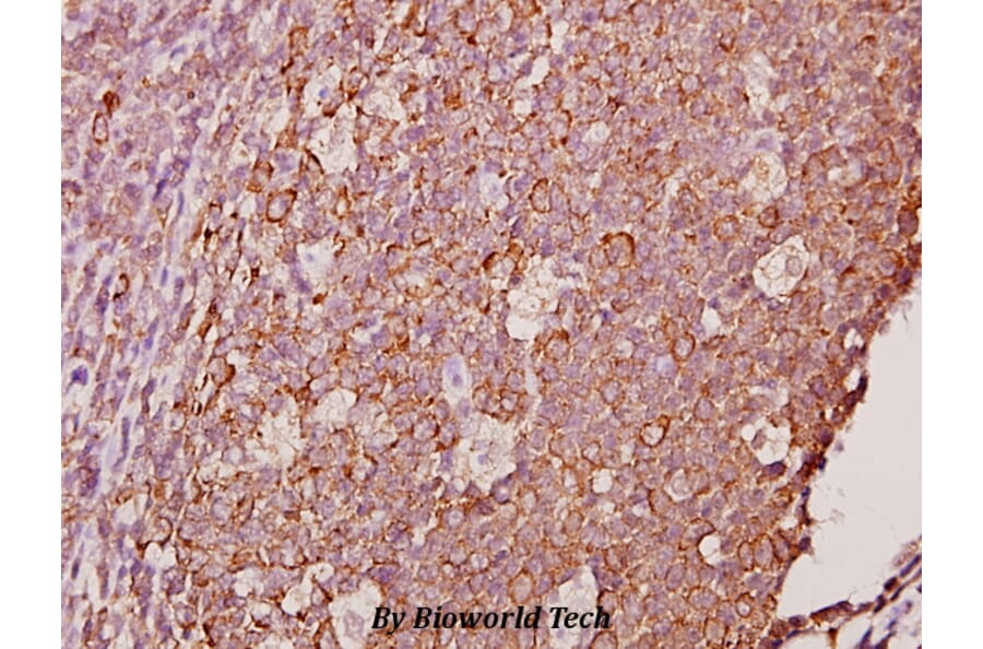 Anti-Ephrin-A1 (K98) Antibody from Bioworld Technology (BS1950) - Antibodies.com