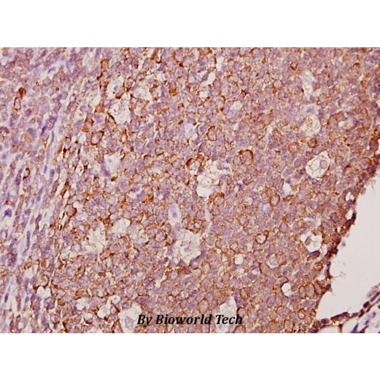 Anti-Ephrin-A1 (K98) Antibody from Bioworld Technology (BS1950) - Antibodies.com