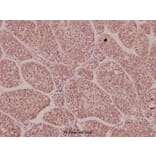Anti-EphA1 (F568) Antibody from Bioworld Technology (BS1952) - Antibodies.com