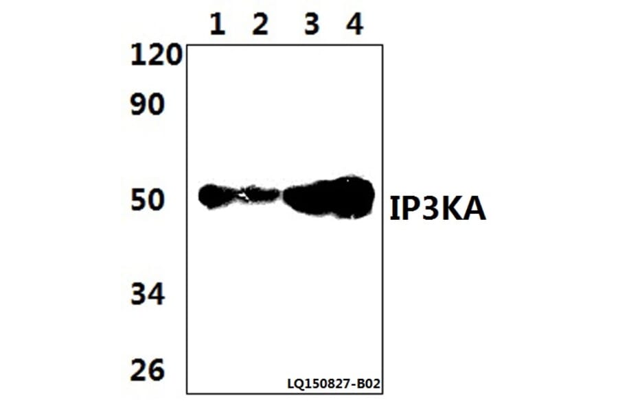 Anti-IP3KA (H431) Antibody from Bioworld Technology (BS1959) - Antibodies.com