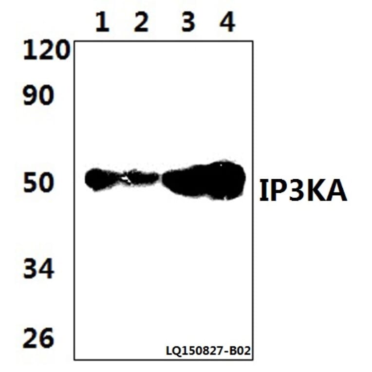 Anti-IP3KA (H431) Antibody from Bioworld Technology (BS1959) - Antibodies.com