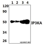 Anti-IP3KA (H431) Antibody from Bioworld Technology (BS1959) - Antibodies.com