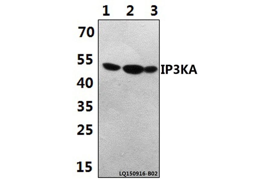 Anti-IP3KA (H431) Antibody from Bioworld Technology (BS1959) - Antibodies.com