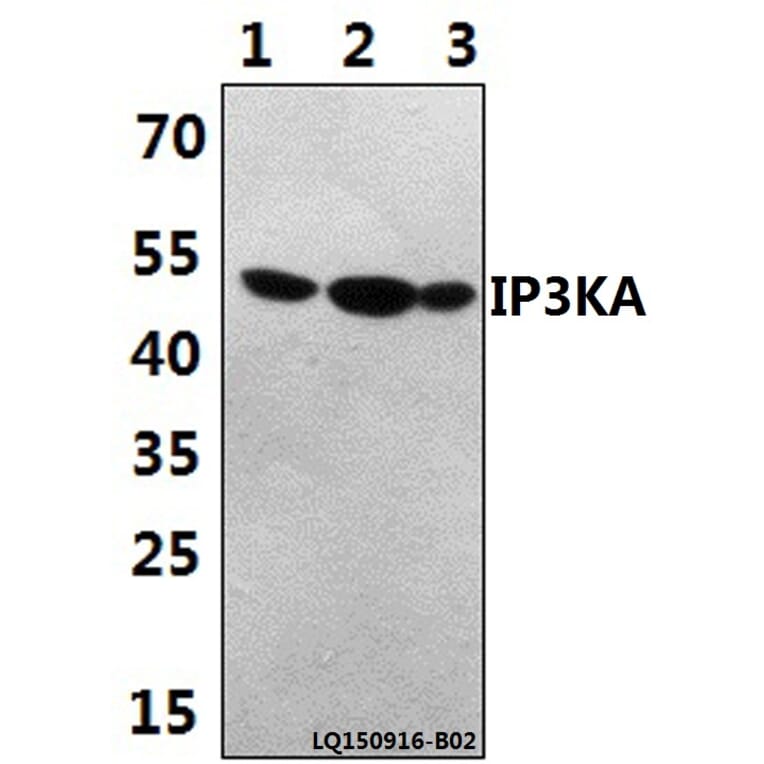 Anti-IP3KA (H431) Antibody from Bioworld Technology (BS1959) - Antibodies.com