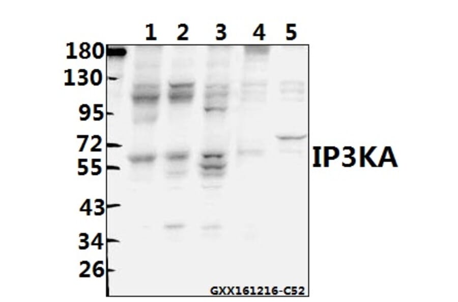 Anti-IP3KA (H431) Antibody from Bioworld Technology (BS1959) - Antibodies.com