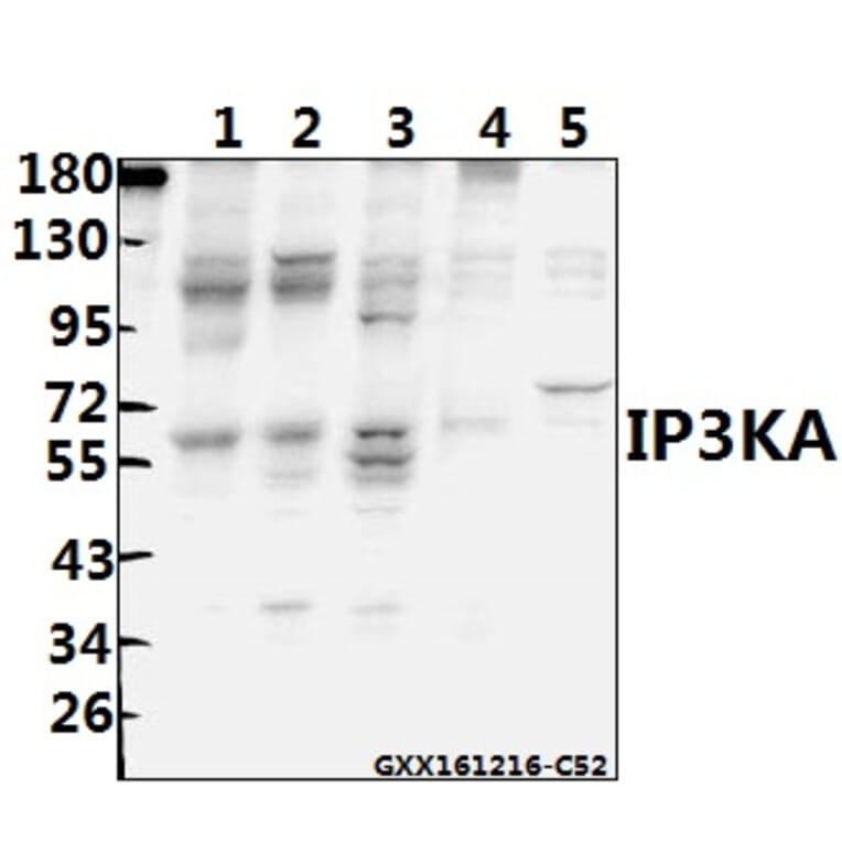 Anti-IP3KA (H431) Antibody from Bioworld Technology (BS1959) - Antibodies.com