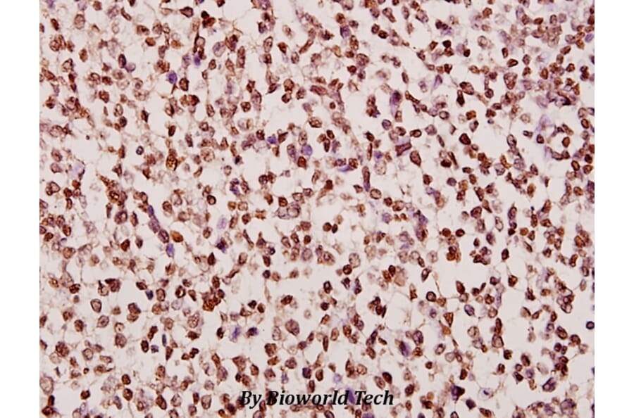 Anti-DGK-α (A340) Antibody from Bioworld Technology (BS1960) - Antibodies.com