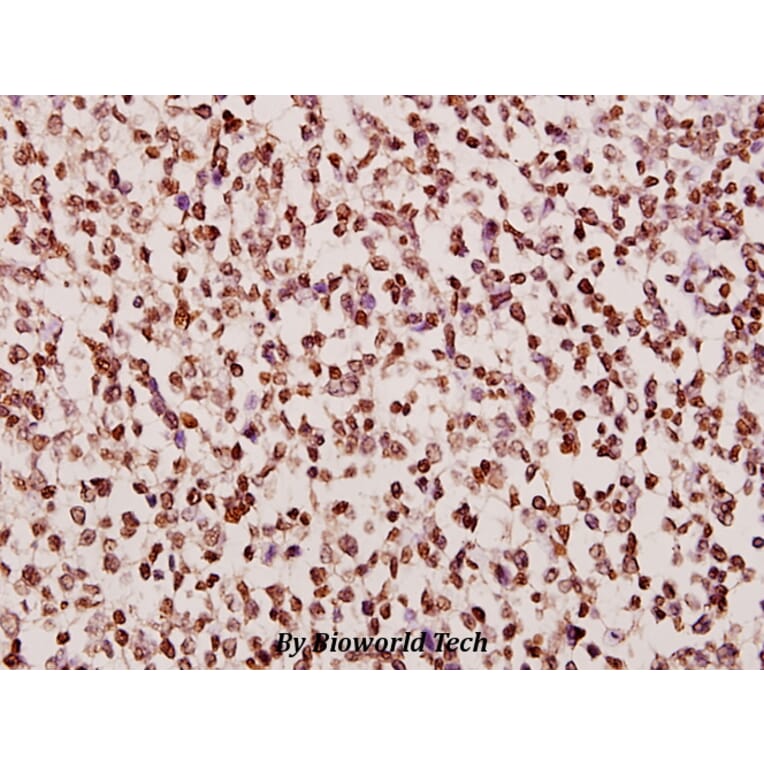 Anti-DGK-α (A340) Antibody from Bioworld Technology (BS1960) - Antibodies.com