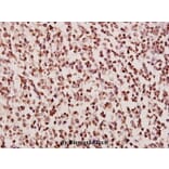 Anti-DGK-α (A340) Antibody from Bioworld Technology (BS1960) - Antibodies.com