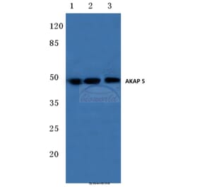 Anti-AKAP 5 (E7) Antibody from Bioworld Technology (BS1962) - Antibodies.com