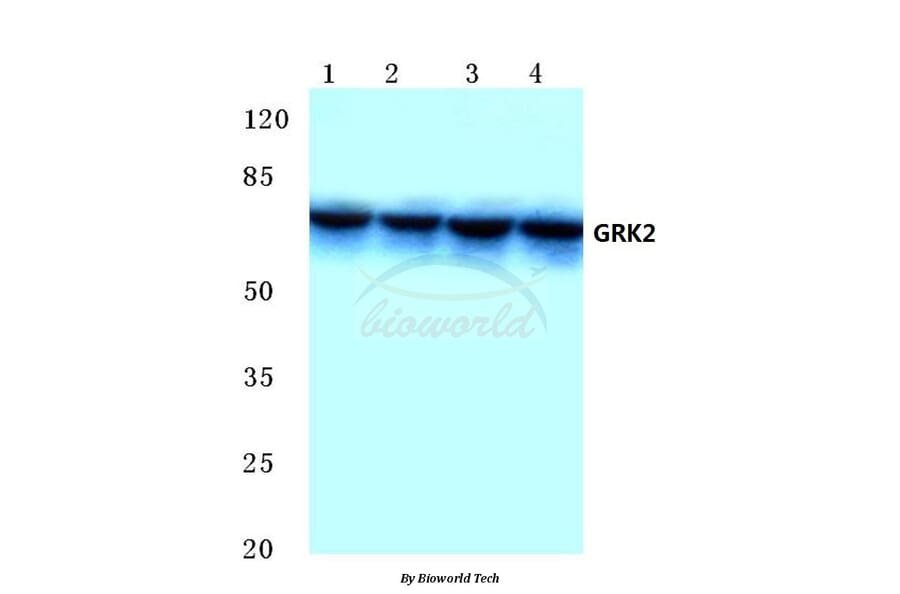 Anti-GRK 2 (D635) Antibody from Bioworld Technology (BS1963) - Antibodies.com