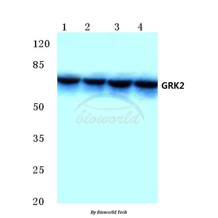 Anti-GRK 2 (D635) Antibody from Bioworld Technology (BS1963) - Antibodies.com