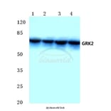 Anti-GRK 2 (D635) Antibody from Bioworld Technology (BS1963) - Antibodies.com