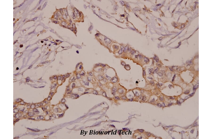 Anti-GRK 2 (D635) Antibody from Bioworld Technology (BS1963) - Antibodies.com