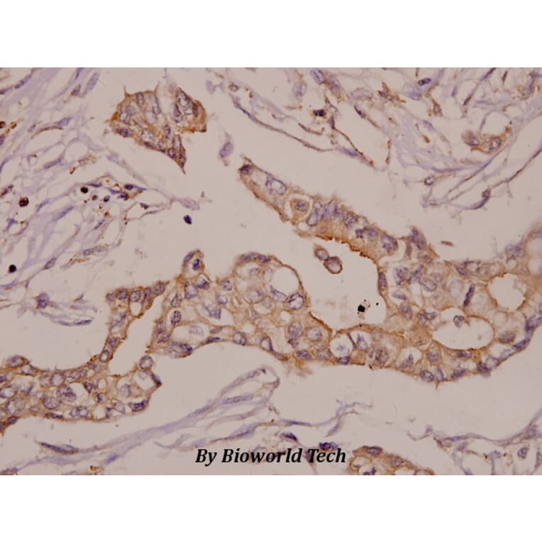 Anti-GRK 2 (D635) Antibody from Bioworld Technology (BS1963) - Antibodies.com