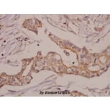 Anti-GRK 2 (D635) Antibody from Bioworld Technology (BS1963) - Antibodies.com