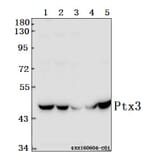Anti-Ptx3 (Y27) Antibody from Bioworld Technology (BS1965) - Antibodies.com
