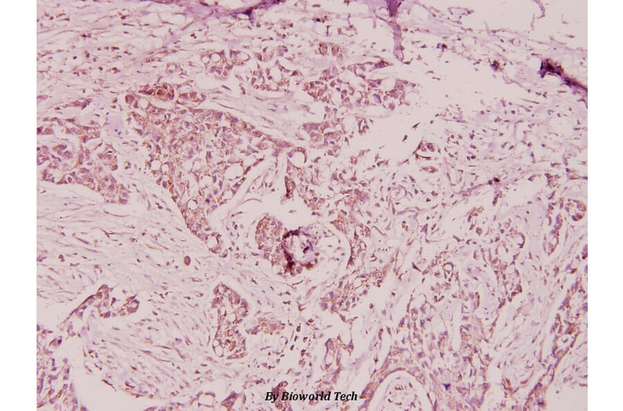 Anti-Ptx3 (Y27) Antibody from Bioworld Technology (BS1965) - Antibodies.com