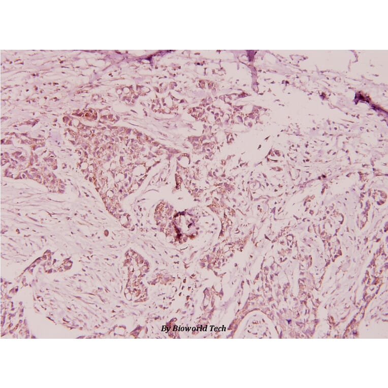 Anti-Ptx3 (Y27) Antibody from Bioworld Technology (BS1965) - Antibodies.com