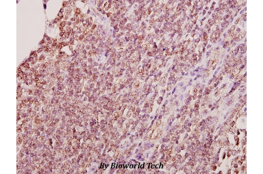 Anti-Hel-N1 (N86) Antibody from Bioworld Technology (BS1966) - Antibodies.com