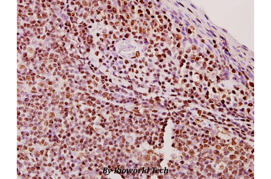 Anti-ERCC5/XPG (E160) Antibody from Bioworld Technology (BS1973) - Antibodies.com