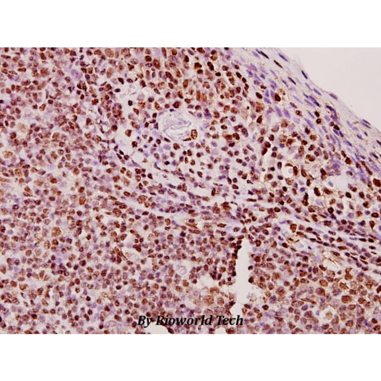 Anti-ERCC5/XPG (E160) Antibody from Bioworld Technology (BS1973) - Antibodies.com