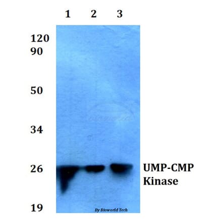 Anti-UMP-CMP Kinase (E36) Antibody from Bioworld Technology (BS1975) - Antibodies.com