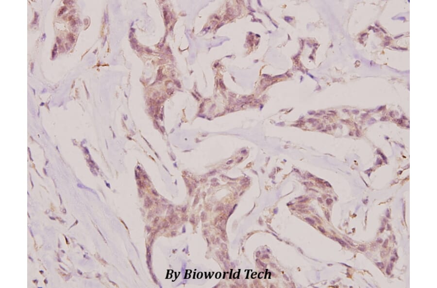 Anti-UMP-CMP Kinase (E36) Antibody from Bioworld Technology (BS1975) - Antibodies.com