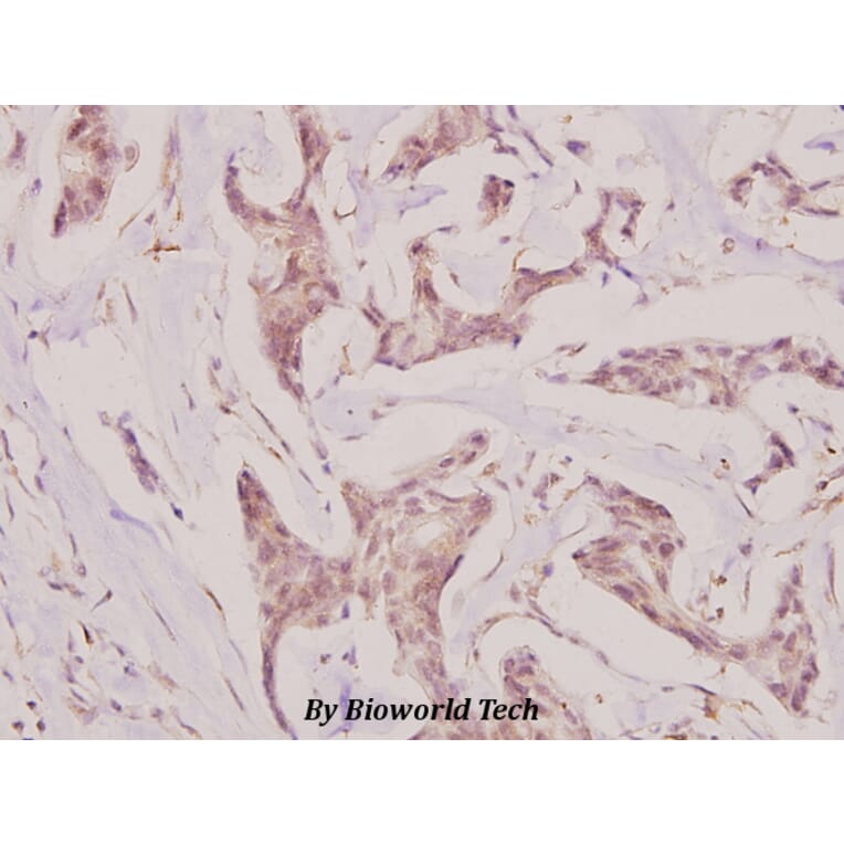 Anti-UMP-CMP Kinase (E36) Antibody from Bioworld Technology (BS1975) - Antibodies.com