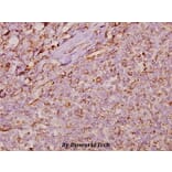 Anti-Cyclophilin F (Y121) Antibody from Bioworld Technology (BS1976) - Antibodies.com