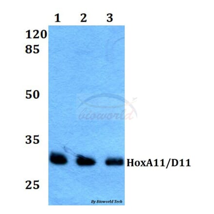 Anti-HoxA11/D11 (Y248) Antibody from Bioworld Technology (BS1977) - Antibodies.com