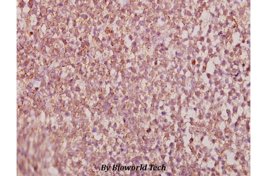Anti-HoxA11/D11 (Y248) Antibody from Bioworld Technology (BS1977) - Antibodies.com