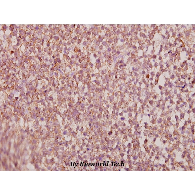 Anti-HoxA11/D11 (Y248) Antibody from Bioworld Technology (BS1977) - Antibodies.com