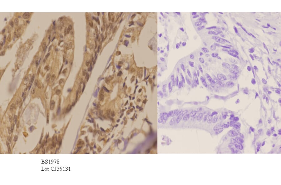 Anti-AKT1 (E40) Antibody from Bioworld Technology (BS1978) - Antibodies.com