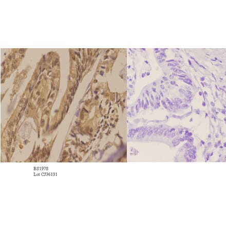 Anti-AKT1 (E40) Antibody from Bioworld Technology (BS1978) - Antibodies.com