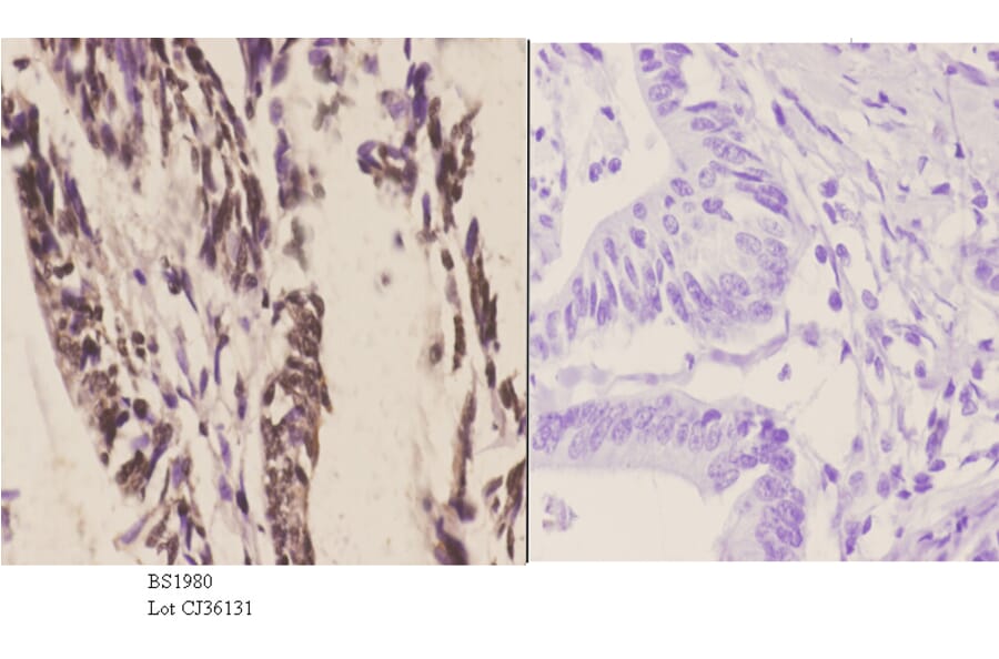 Anti-CstF-64 (R46) Antibody from Bioworld Technology (BS1980) - Antibodies.com