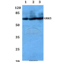Anti-GRK5 (Q382) Antibody from Bioworld Technology (BS1981) - Antibodies.com